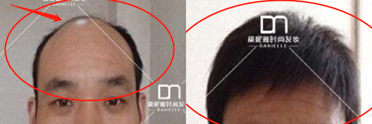 男士形象改造 | 拯救的不仅是外形，更是自信！